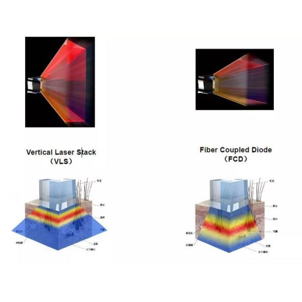 GOMECY 755NM 808NM 1064NM Fiber laser hair removal machine