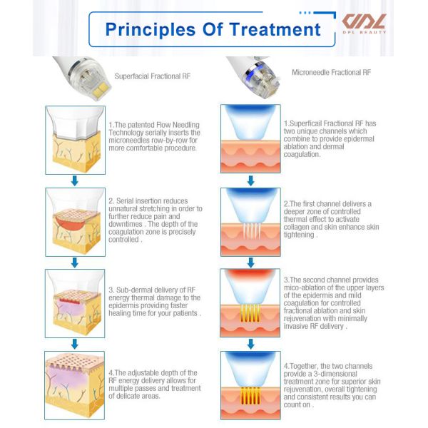 MJ0002 200w Multifunction 2 In 1 Insulated Needle With RF Miconeedle Portable Facial Skin Tightening RF output