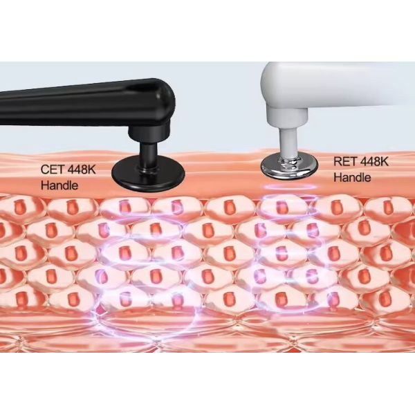 448K Body Care Therapy Equipment For Relaxing Muscle Pathology Arthritis
