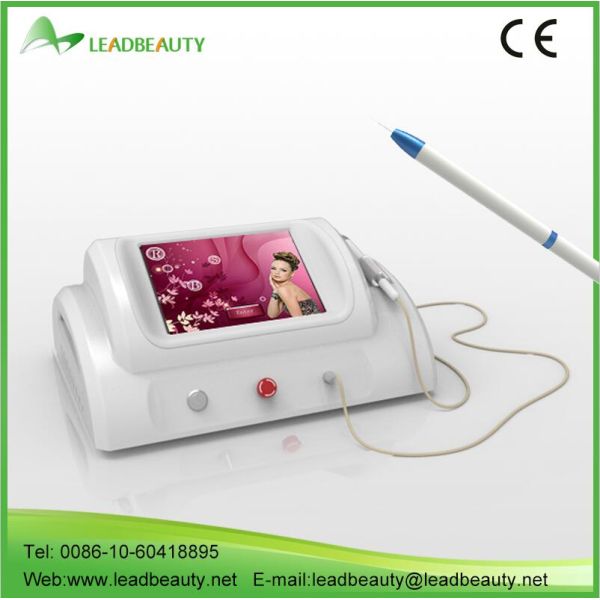 Radiofrequency Ablation Varicose Veins / Spider Vein Removal Painless 30Mhz