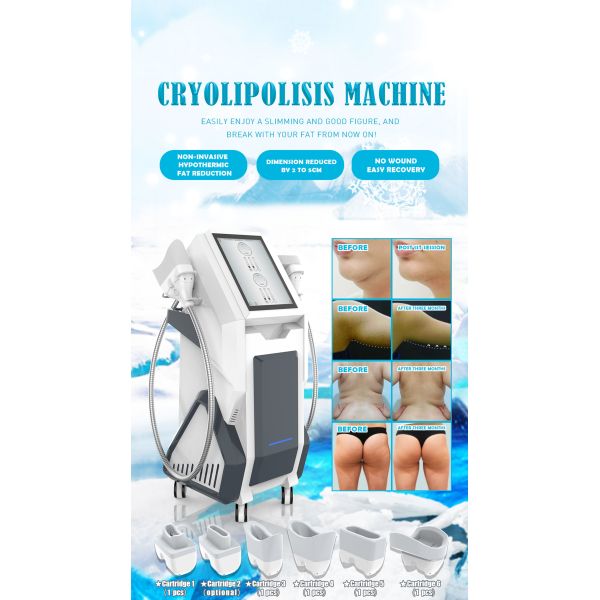 RF 360 Cryolipolysis Slimming Machine Non Invasive Cavitation ISO90 Approval