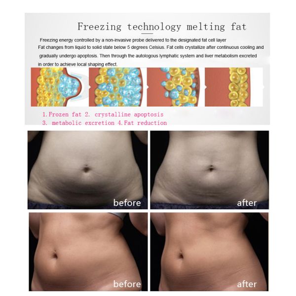 Weight Loss Equipment / Cryolipolysis Slimming Machine For Beauty Salon