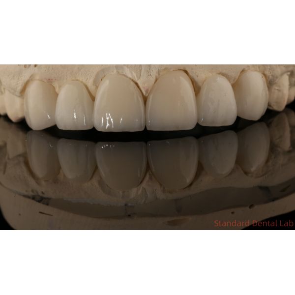 Precise Zirconia Crown Bridge Comfortable Fit / Esthetics 3-4 Days Quick Turnaround Time