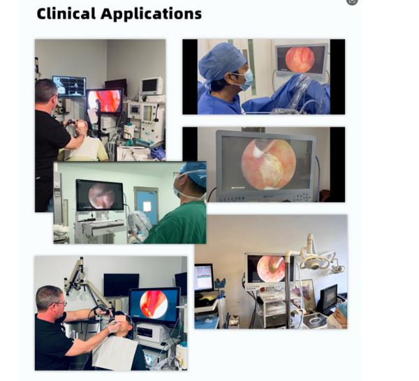 24  Monitoreo Endoscopio Médico Cámara para Cirugía Laparoscopio Endoscopio Urología Artroscopio