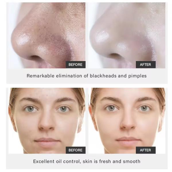 OEM ODM Máscara de lama Cuidados faciais Blackheads Acne Limpar suavemente Pôr lama vulcânica bambu carvão Kaolin argila Máscara facial
