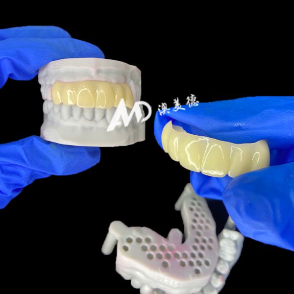 PMMA Provisional Implant Bridge with Hollow Inside for Stability and Natural Healing, High-precision CAD/CAM Fabrication, Biocompatible PMMA Material