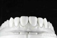 Finition de dentition flexible révolutionnez votre pratique dentaire avec la morphologie dentaire naturelle la technologie d'arrangement des dents et la propriété légère