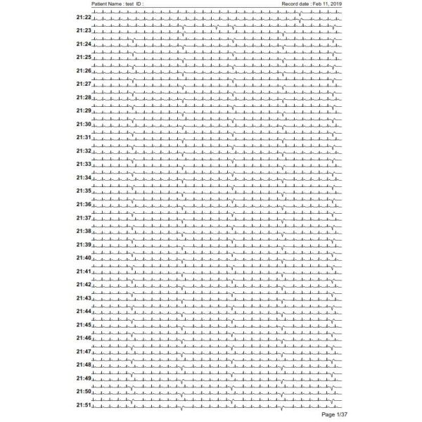 High Accurate Portable Wireless Vital Signs Monitor For Family Clinical Healthcare