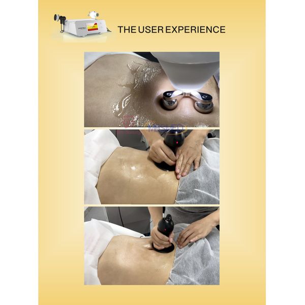 448k Текар терапевтический аппарат для облегчения боли физическое устройство для лечения спортивных травм