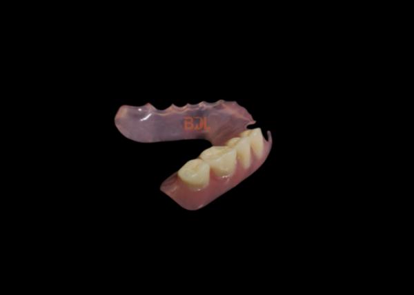 No Metal Showing Hypoallergenic Flexible Partial Denture with 3-Day Turnaround for Comfortable Dental Restoration