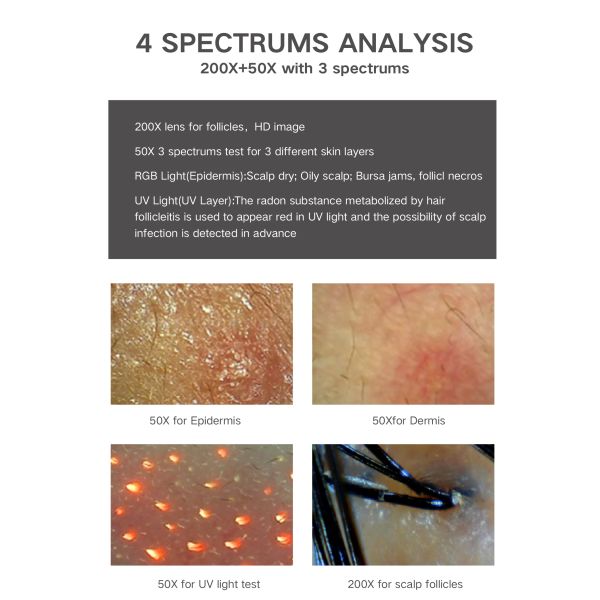 ABS PC 15 Inch HD Screen 200X Camera USB Digital Hair And Skin Analyzer