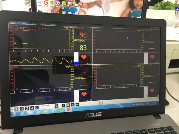 CD Software Audio Alarm Finger Oximete Wireless OLED USB Pulse Oximeter Blood Oxygen SPO2 / PR CMS50EW Bluetooth Oximete