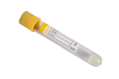 Yellow 8ml Vacuum Blood Collection Tubes  Specimen Integrity Protection Gel Clot Activator