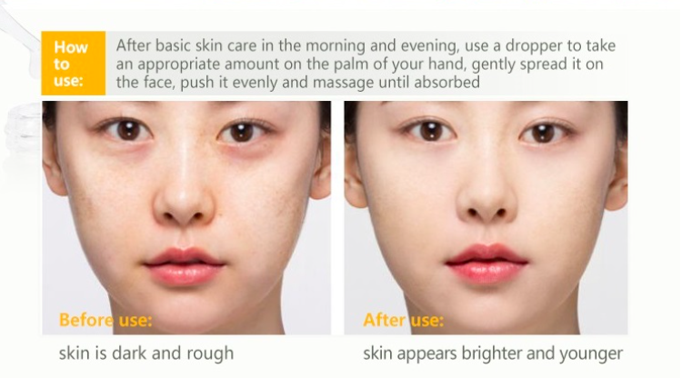 OEM 30ml Hyaluronic Acid Aloe Vera Organic Face Serum