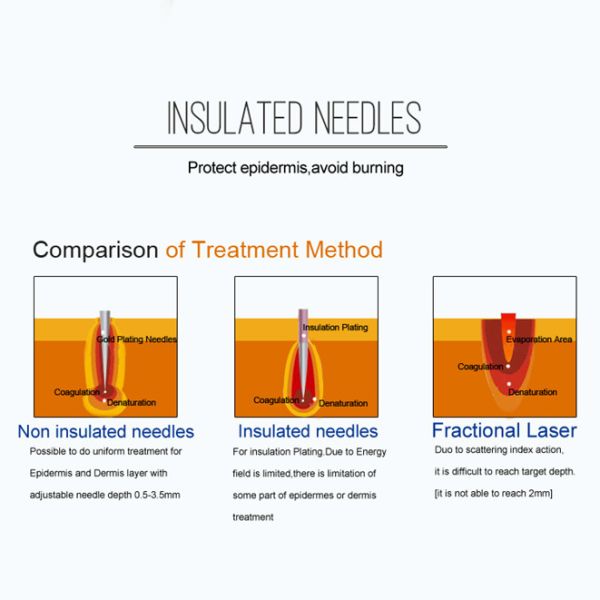 Портативное оборудование для омоложения Microneedle RF красоты частичное затягивая
