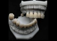 Resistência à ruptura da coroa dental de zircônia para dentes únicos ou múltiplos