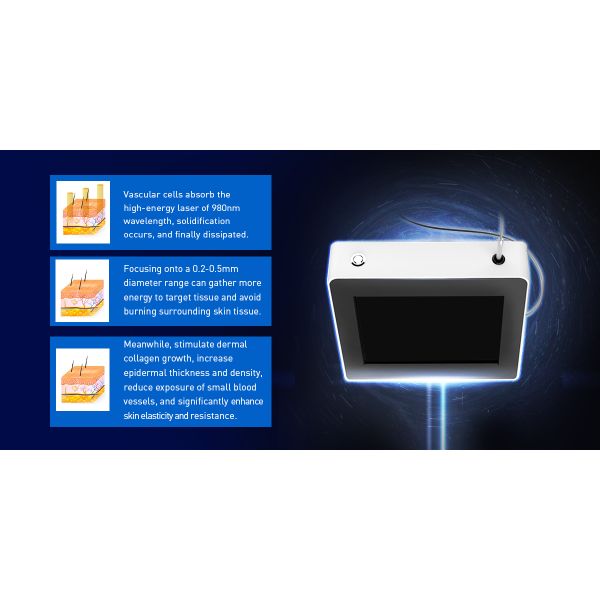 Лазер 980nm диода машины лазера лазера профессионального диода удаления 980nm вены паука 30W васкулярный