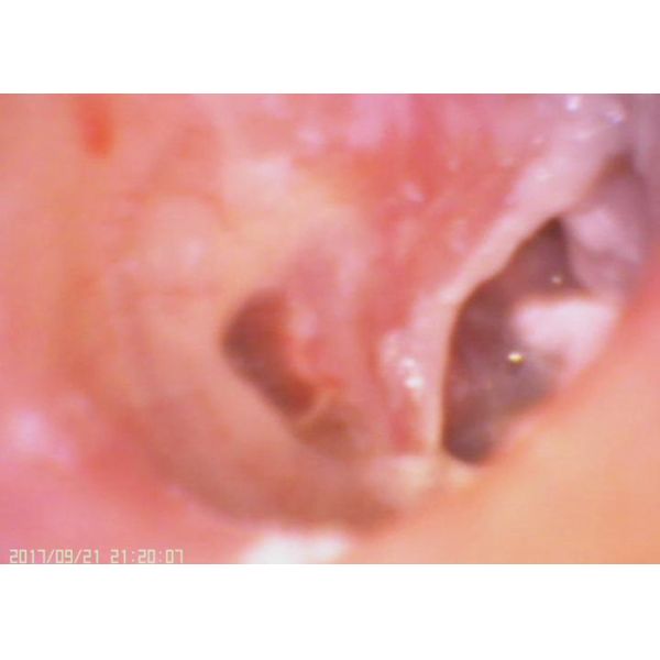 laryngoscope médical d'otoscope de caméra de gorge d'oreille de Digital d'écran d'affichage à cristaux liquides de 3,5 pouces