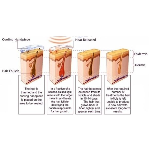 Two - Handle Type IPL Hair Removal Machine For Full Body FDA Approved