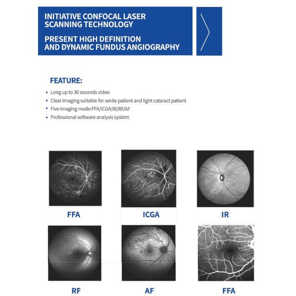 Confocal Retina Ophthalmoscope One Integrated Lens Camera System Multi Imaging Modes