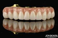 Titanium And Zirconia Comfort Comfortable To Wear Ti-Bar Zirconia Hybrid Bridge For Replacement Of Missing Teeth