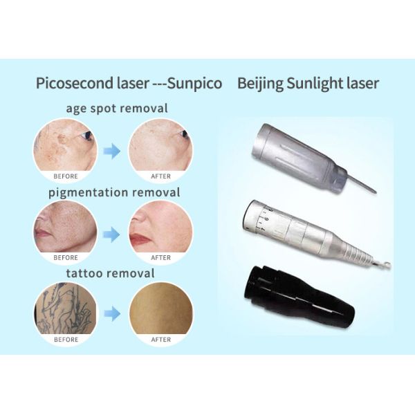 2000MJ Alexandrite Picosecond Laser Tattoo Removal Machine 755Nm Black And Blue