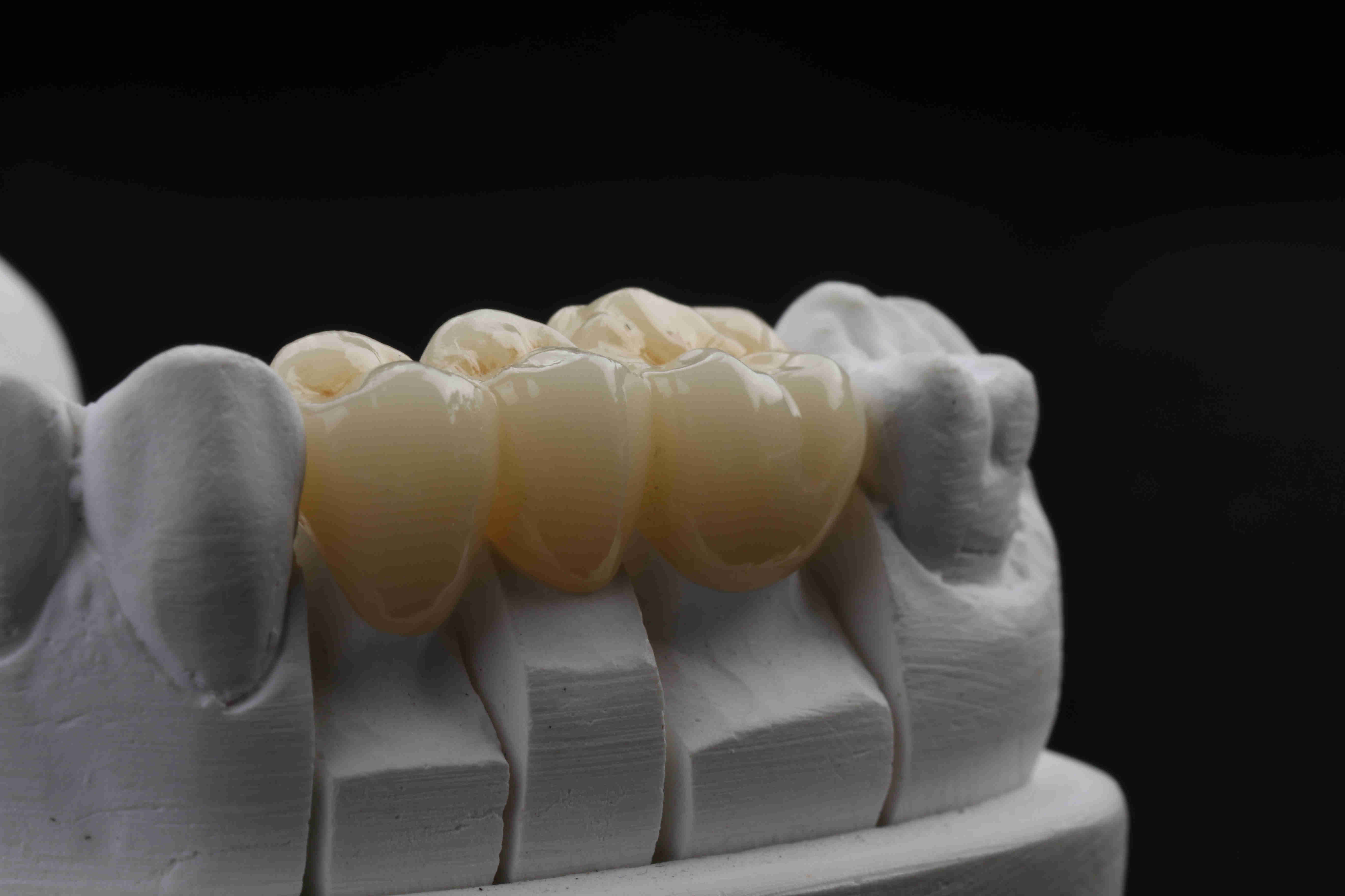 Pre покрашенный блок Zirconia 3D 98*16mm разнослоистый