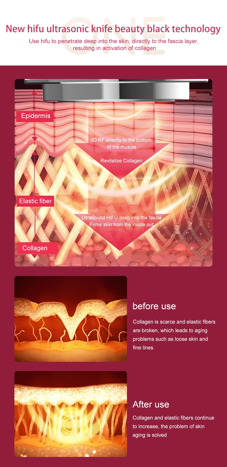 4 в продуктах 1 ухода за лицом красоты Ems красоты машины ухода за лицом машины заботы кожи HIFU поднимаясь оптовых