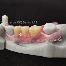 Valplast Flexible Denture Unique Material Flexibility Comfort Adapting to Mouth