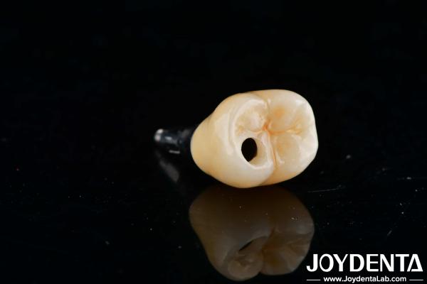 Internal Hex Titanium Dental Implants Precision Machining With Zero Angulation