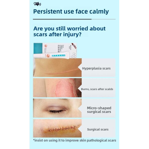 Scarred Skin Scar Removal Gel Soothing For Dermatological Pathological Scars