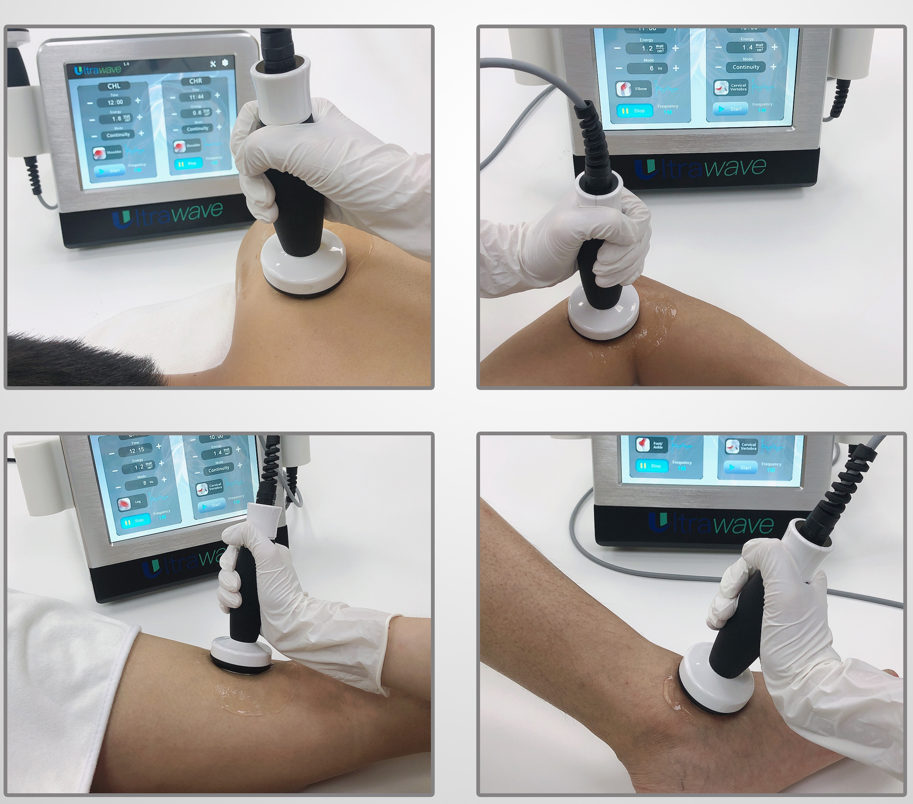 Машина красоты физиотерапии 220V Ultrawave портативная для облегчения боли тела