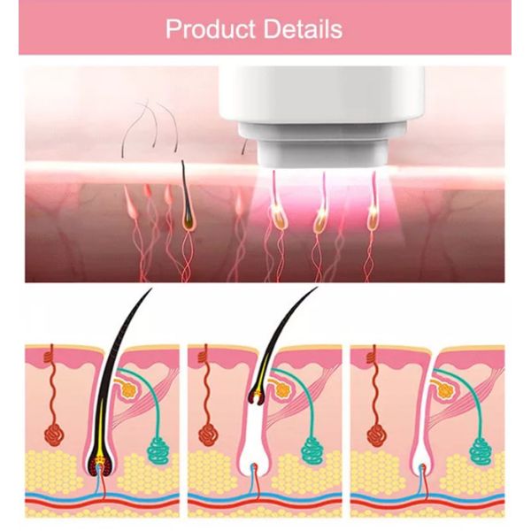 Blood Vessels IPL Hair Removal Machine 690nm Facial Hair Removal Laser Machine