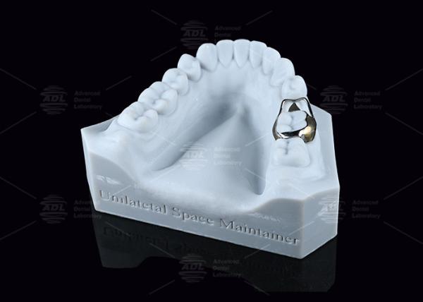 SS Pediatric Space Maintainer Comfortable Hygienic Dental Space Maintainer For Adults