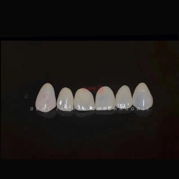 Tooth Like Shells Dental Porcelain Emax Veneers Dsd Design China Dental Lab