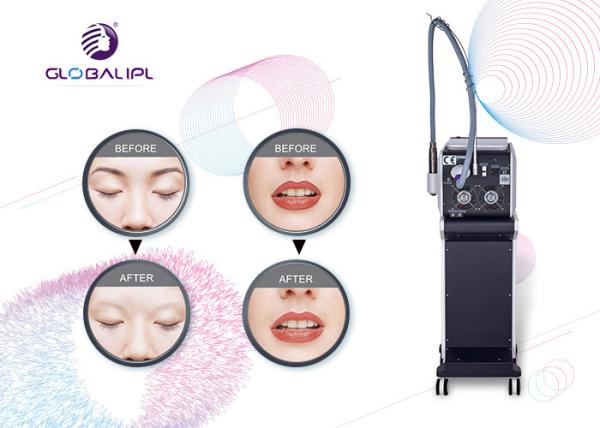 Máquina da remoção da tatuagem do ND YAG do interruptor do equipamento Q da beleza do laser IPL RF de Pico