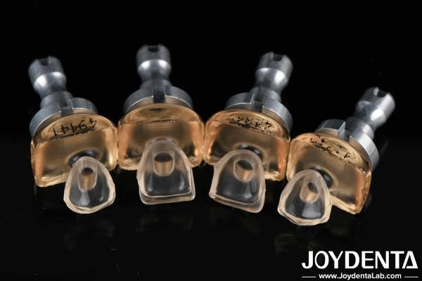 High Biocompatibility Glass Porcelain Ceramic Veneers 0.3mm-0.8mm For Teeth Whitening