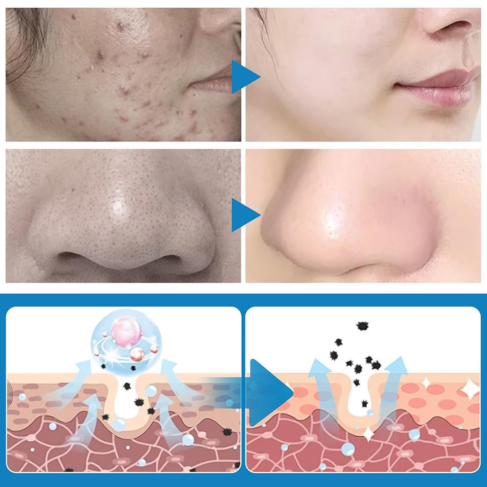 OEM ODM brand customized natural turmeric kojic acid pad brightening turmeric kojic acid cleaning acne removing skin care essence toner