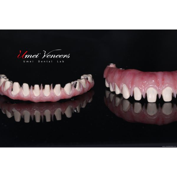 Sturdy zirconium oxide bridge frame