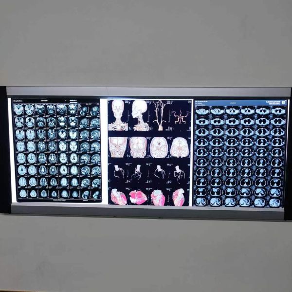 Принтер фильма ФУДЗИ 3500 медицинский сухой