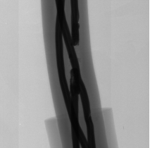 PCB Inspection Machine with 5