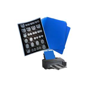 210um 8x10 A3 A4 Синяя медицинская струйная пленка для рентгенологии