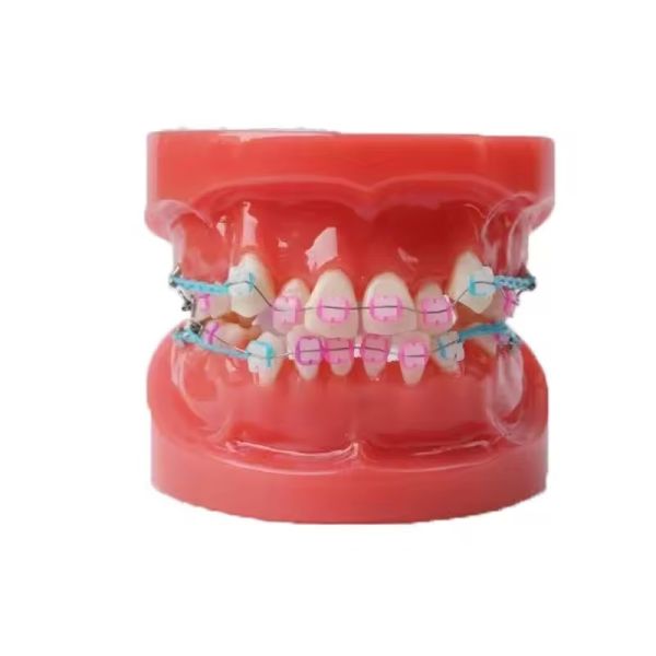Treinamento Uso de Dentes Dentários Modelo de Ensino Modelo Ortodôntico Dental Funcional Sem Bracket