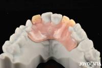 Estructura Oral Estable Marco de Efectos Establecer Dientes Finish Diseño de apariencia hermosa y armoniosa