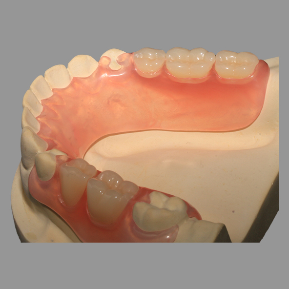 Dental Lab Crown |  Casting Pink TCS Flexible Partials With Excellent Retention