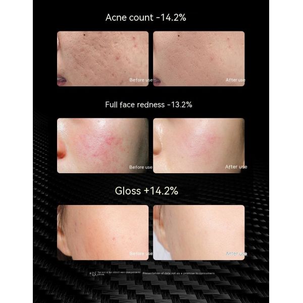 Hight Quality Medical Beauty Led Mask with Led Light Therapy Face Mask Infrared Led Mask Silicone