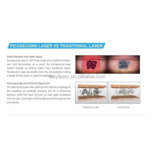 прибор машины 1064nm Microdermabrasion удаления татуировки лазера 755nm 532nm picolaser