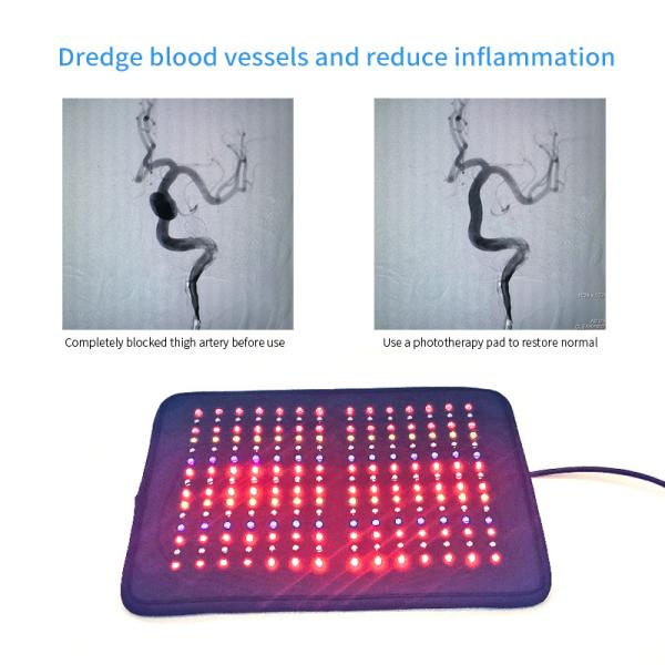 Four Colors Led Light Therapy Machine Rheumatism Treatment Skin Rejuvenation