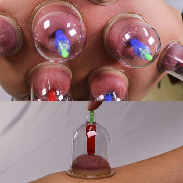 Anti Cellulite Massage Vacuum Suction Cup Therapy Set 12 Gua Sha Massage Tools 3in1 in Box