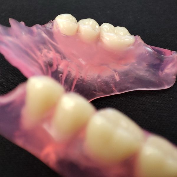 Valplast Flexible Denture Invisible Base Similar Natural Gum Color Persistent Color Change